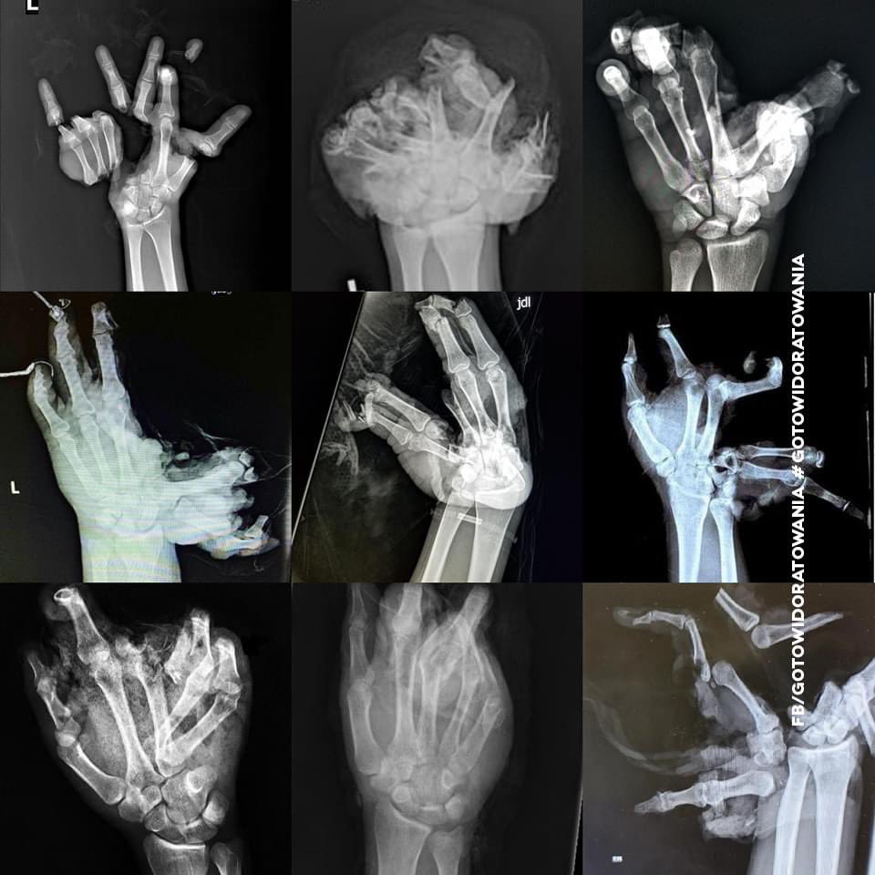 Już jutro otwarcie sezonu na 
orto-puzzle