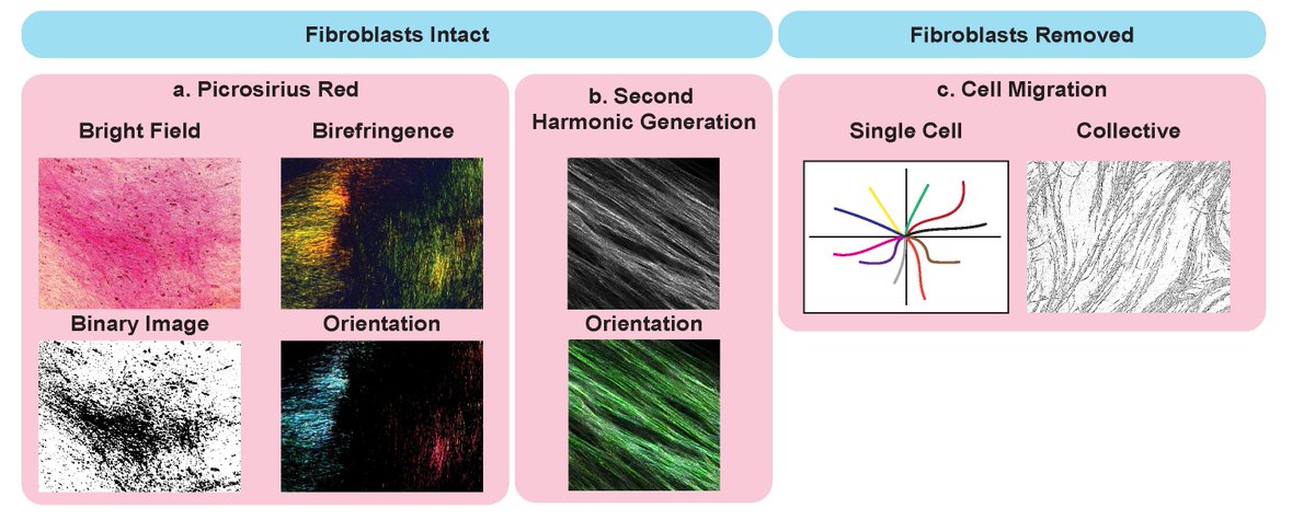Bio-protocol (@bioprotocolbyte) on Twitter photo *New protocol alert!*
#CELL -derived #Matrix #Assays to Assess Extracellular Matrix Architecture and #track #CELL #movement"
bit.ly/3WGG4na
<a href="/KendelleJMurphy/">Kendelle J Murphy</a> <a href="/daniel_reed_/">Daniel Reed</a> <a href="/jessiezhu_/">Jessie Zhu</a> <a href="/brooke_pereira_/">Brooke Pereira, PhD</a> <a href="/paultimpson7/">paul timpson</a> <a href="/GarvanInstitute/">Garvan Institute of Medical Research</a> <a href="/Timpson_Lab/">Invasion and Metastasis Lab</a>
Congratulations!!!👏 *New protocol alert!*
#CELL -derived #Matrix #Assays to Assess Extracellular Matrix Architecture and #track #CELL #movement"
bit.ly/3WGG4na
<a href="/KendelleJMurphy/">Kendelle J Murphy</a> <a href="/daniel_reed_/">Daniel Reed</a> <a href="/jessiezhu_/">Jessie Zhu</a> <a href="/brooke_pereira_/">Brooke Pereira, PhD</a> <a href="/paultimpson7/">paul timpson</a> <a href="/GarvanInstitute/">Garvan Institute of Medical Research</a> <a href="/Timpson_Lab/">Invasion and Metastasis Lab</a>
Congratulations!!!👏
