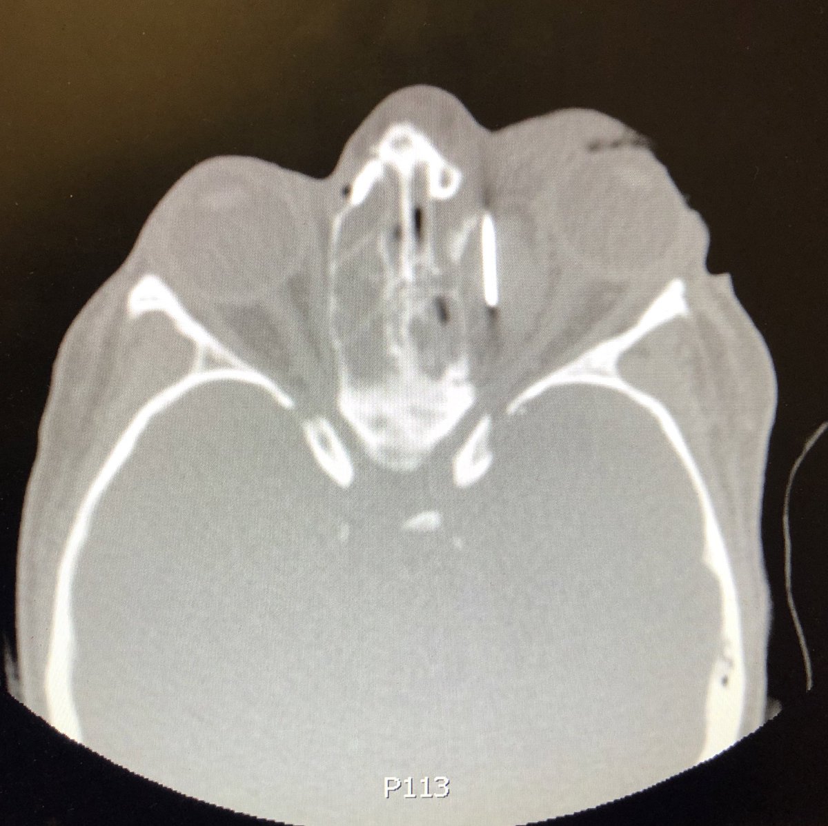 Dr. Dario Teplisky tweet media