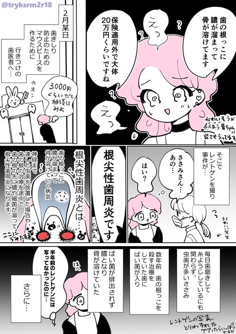 歯の病気で骨が溶けて治療で20万飛んだ話
#根尖性歯周炎 #フィクション漫画 