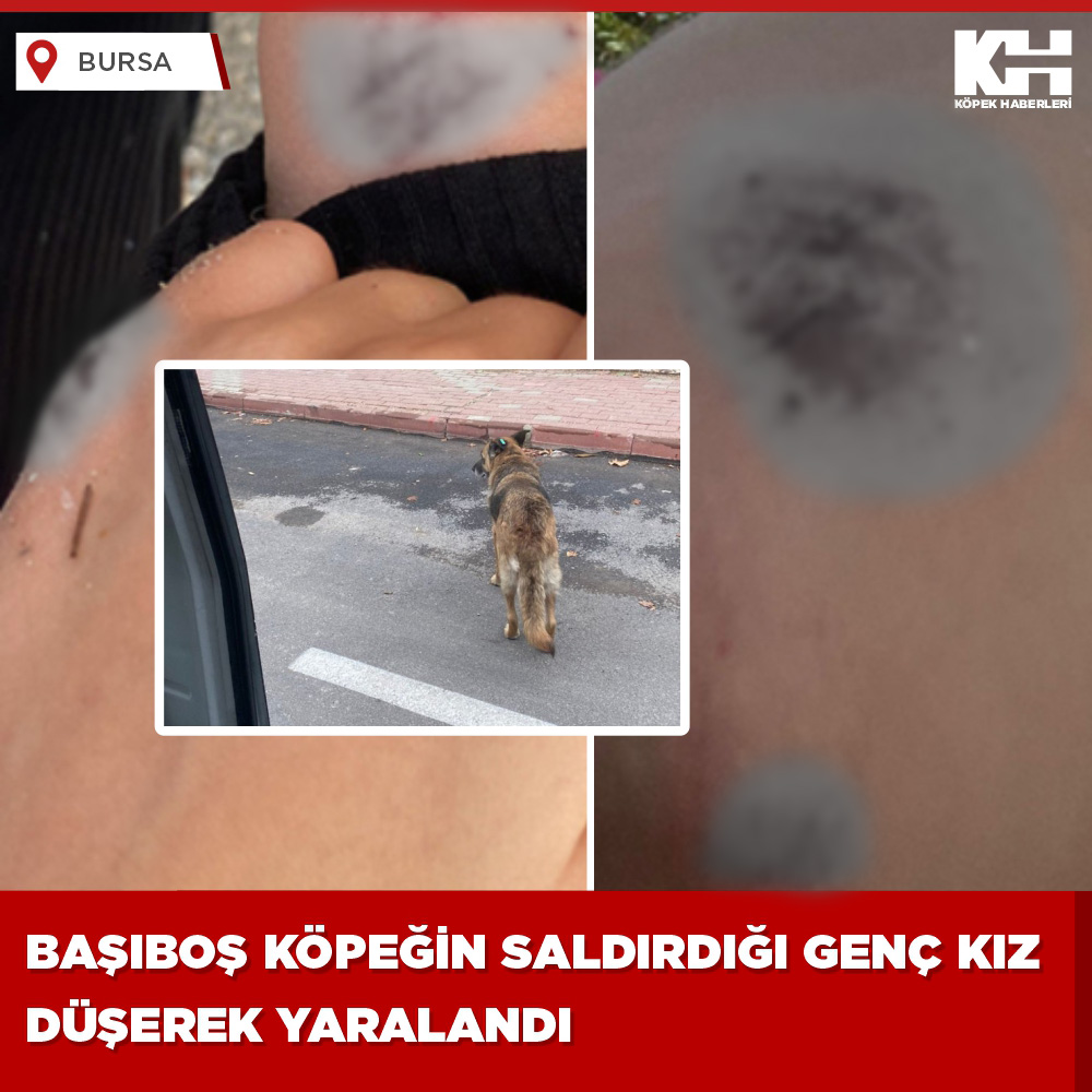 Bursa, İnegöl ilçesinin Yeniceköy mahallesinde başıboş köpeklerin saldırısından kaçmak isteyen 20 yaşındaki genç kız düşerek yaralandı
#kuduz .
2 hafta önce aynı mahallede  yine bir köpek saldırısından kaçmak isteyen küçük çocuğa araba çarpmasından dolayı mahalle sakinleri eyl...