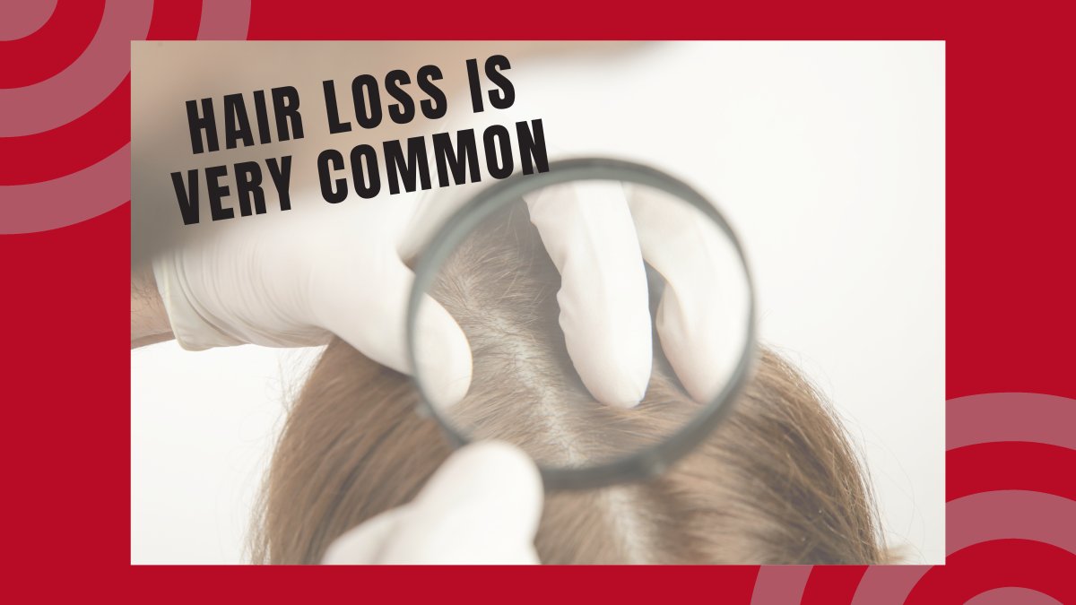 LasercapCompany's tweet photo. Trust us, you're not the only one! Hair loss affects over 80 million Americans. By the age of 35, two-thirds of men will experience some form of hair loss, AND 40% of Americans who experience hair loss are women. Learn how The Original LaserCap can help! https://t.co/7PGWQjMTi1 https://t.co/zmVtMz6NtG
