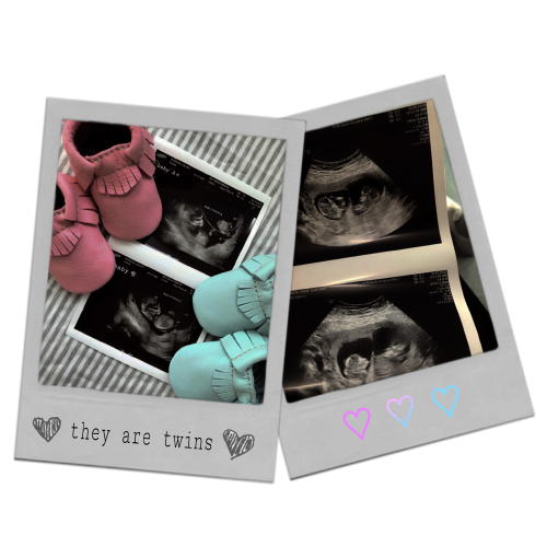 TEENWITCH_'s tweet photo. ⠀
⠀
⠀⠀⠀⠀⠀ ❛    💜💙    𓈒 𓈒 𓈒    It's   ɑ    𝐛𝐨𝐲
⠀⠀⠀⠀ ⠀ɑnd  ɑ   𝐠𝐢𝐫𝐥  .  We   ɑre   𝙩𝙬𝙤
⠀⠀⠀⠀    𝘪 𝘯    𝘮 𝘰 𝘮 𝘮 𝘺' 𝘴    𝘣 𝘦 𝘭 𝘭 𝘺 𔘓

⠀⠀⠀⠀⠀⠀ https://t.co/VK2VZBdrnf