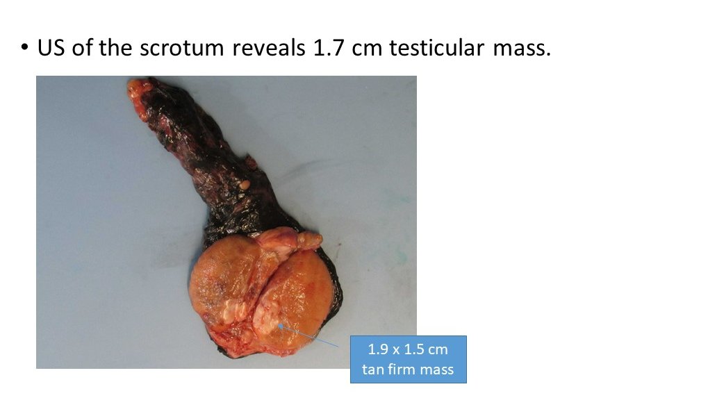 NYULISOM Pathology tweet media