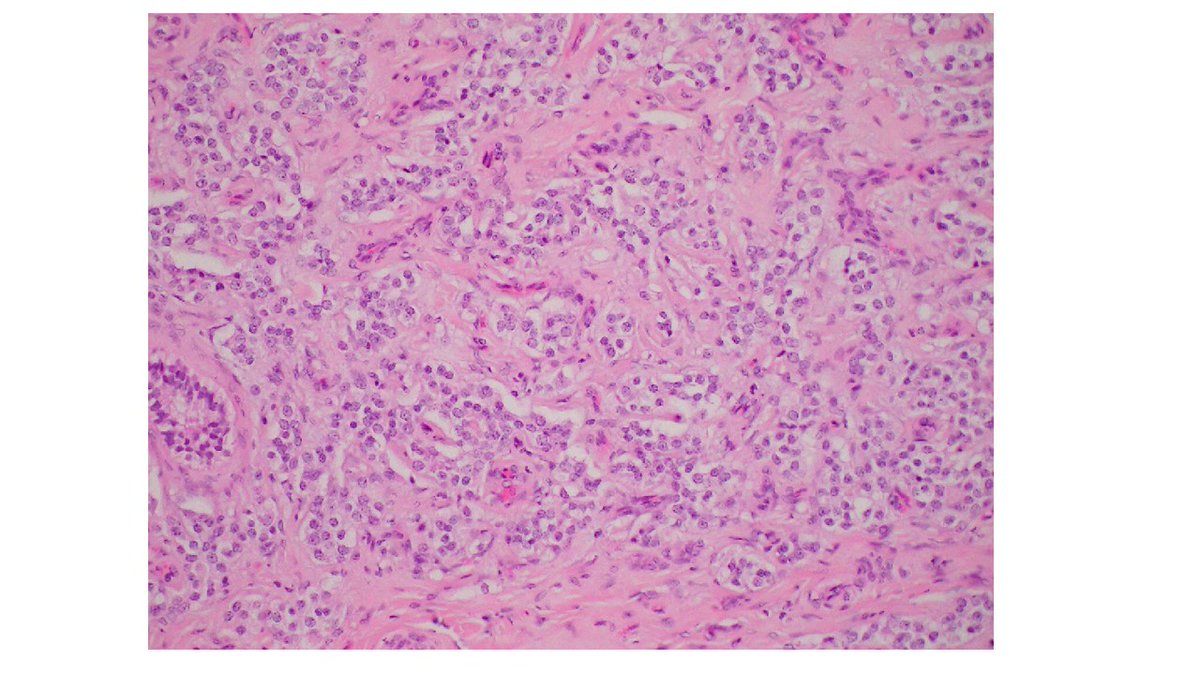 NYULISOM Pathology tweet media