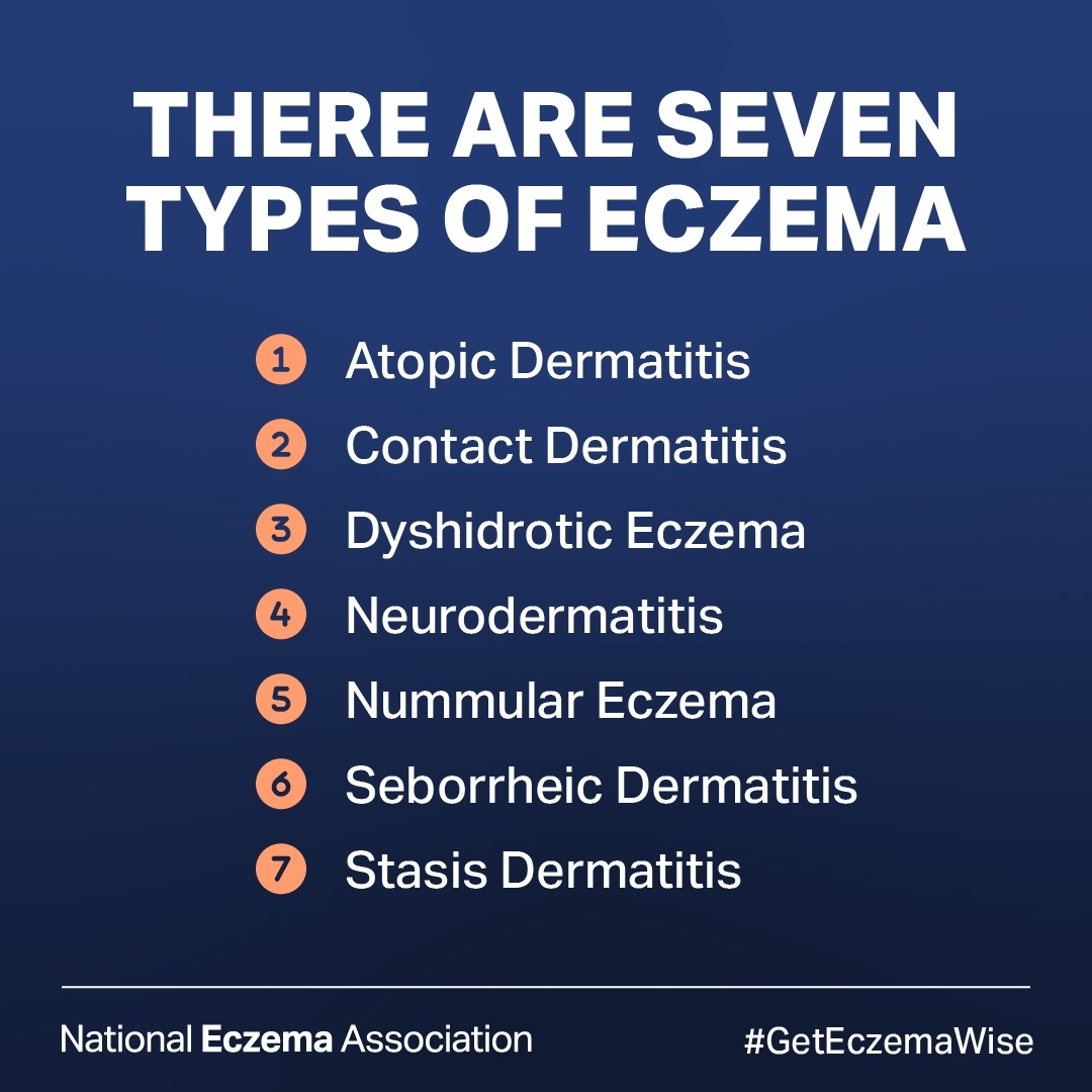 nationaleczema's tweet photo. Tell us in comments which types of #eczema you have or have had, and learn more about the seven types of eczema here: https://t.co/EeXlUiDjOI

#DyshidroticEczema #atopicdermatitis #SeborrheicDermatitis #NummularEczema #Neurodermatitis #StasisDermatitis #contactdermatitis https://t.co/6rDMa9n7ad