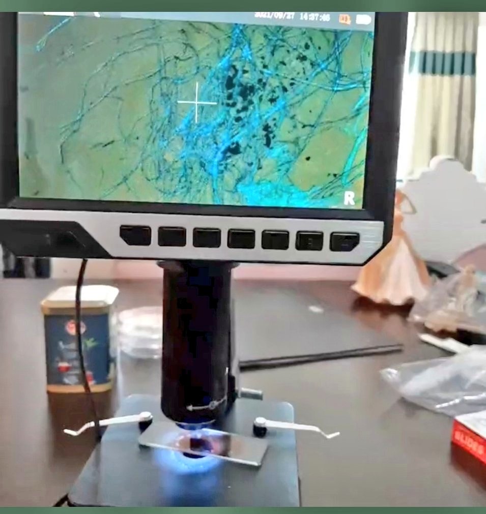 SerpilOzkan99's tweet photo. ‼️Dikkat önemli! 

Hacamata ikna edemediğiniz aşılı yakınlarınızın idrar örneğini bir cam kavanoza koyun.Kapağı kapatın,dememe gerek yok.WIFI'nin yanında sadece 3 gün bekletin.Sonra,beyaz seramik bir tabağa koyup,telefonun video ayarı ile iyice yaknlştrp graphenleri görüntüleyin+ https://t.co/hlPK2ZNqBq
