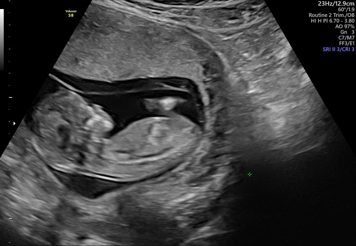 Lea Catherine 🐝🐝 tweet media