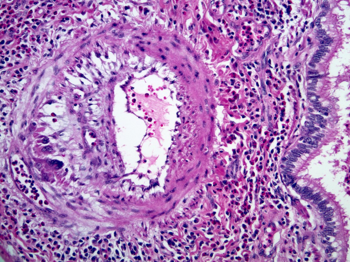 Sanjay Mukhopadhyay on Twitter: