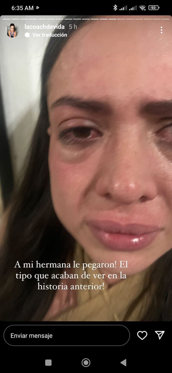 SmilerGun's tweet photo. @anakpricornia @Aylinperez93 El esposo de jahaira le pego a la novia de juan sebastian ... eso es lo unico que se sabe ... mas alla de eso .. son chismes .. es mejor dejar a que se aclaren las cosas antes de tomar partido https://t.co/H1pjMCdsUT