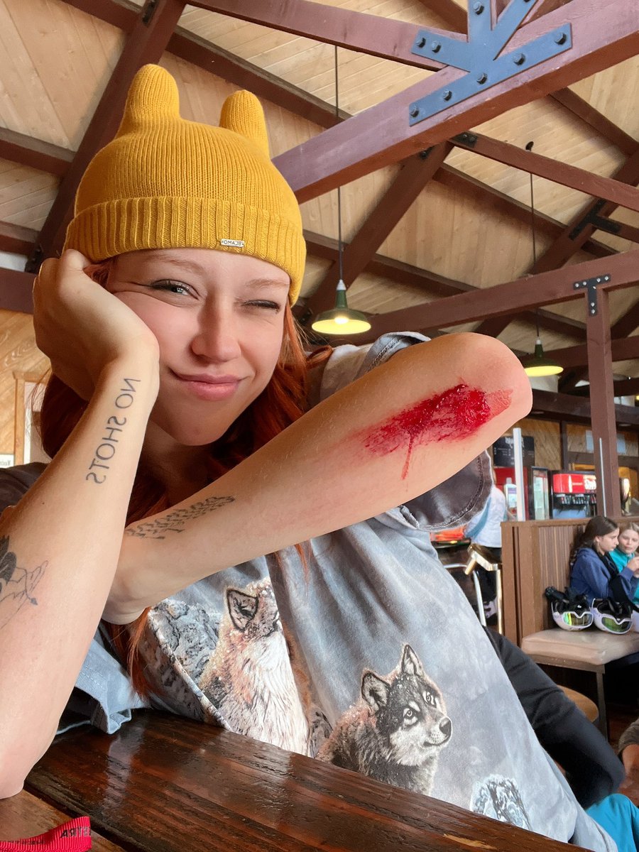 Sabrina05669735's tweet photo. I got hurt but it’s ok I think it’s makes me look tough and sexy https://t.co/nOkIamrK8t
