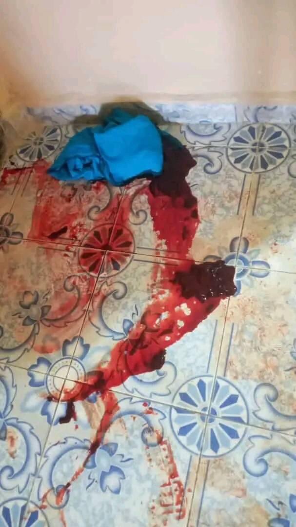 AbdalahAlcadala's tweet photo. @VPsomaliland Killing innocent people demonstrating peacefully, using the UK's forces trained to fight against terrorism, is it not a big crime?!
Somaliland must leave Lasanood!
#SSC_Genocide๐ญ https://t.co/lnPrNGbuey