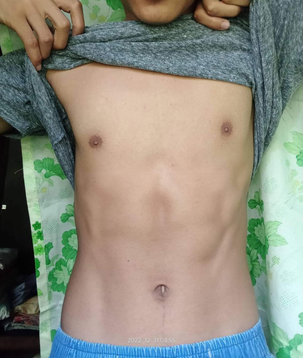 TopHyungDaddy's tweet photo. Kunting Workout pa
#Futness
#FitnessMotivation
#workout https://t.co/eJNIu5jYM4
