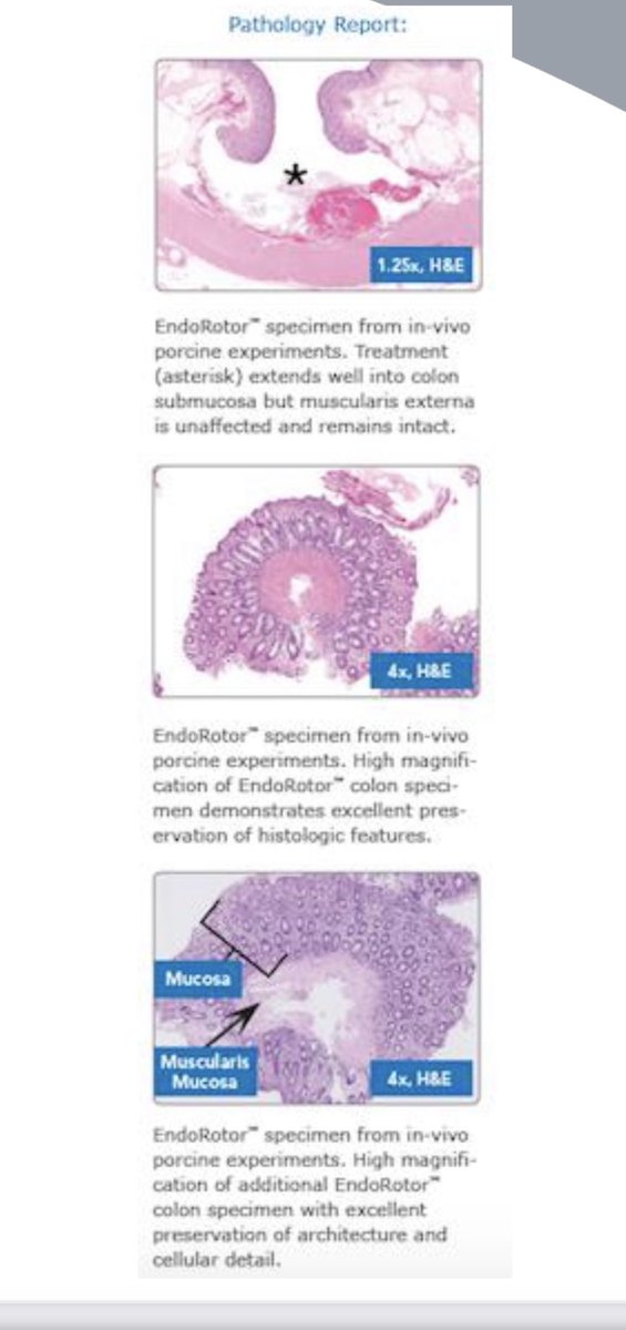 Interscope Inc. (EndoRotor®) tweet media