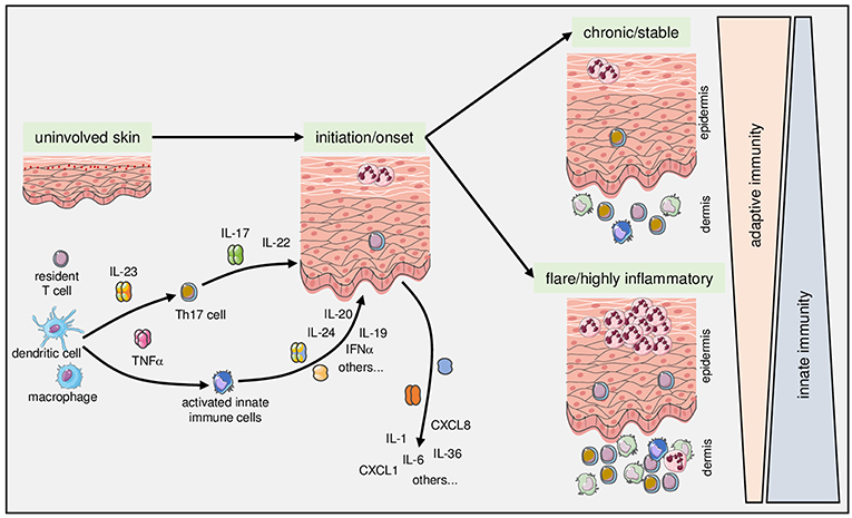 charles_breeze's tweet photo. What do we know about the cell type-specificity of psoriasis? How has this advanced via EWAS/GWAS in 2022? A ๐งต #eFORGE #EWAS #GWAS #chromatin #epigenetics @ENCODE_NIH @IHEC_Epigenomes (image from https://t.co/K5EaI7OZ4C) https://t.co/hFlqYYgsYw