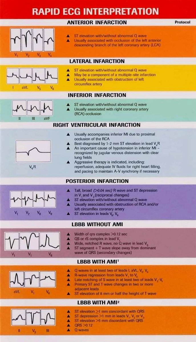 Paul_Wischmeyer's tweet photo. ❤️ Excellent ECG interpretation Overview
#MedEd #Medtwitter #FOAMed
#FOAMcc #medicalstudents #TipsForNewDocs #ECG #medicine https://t.co/m8VVtRLp55