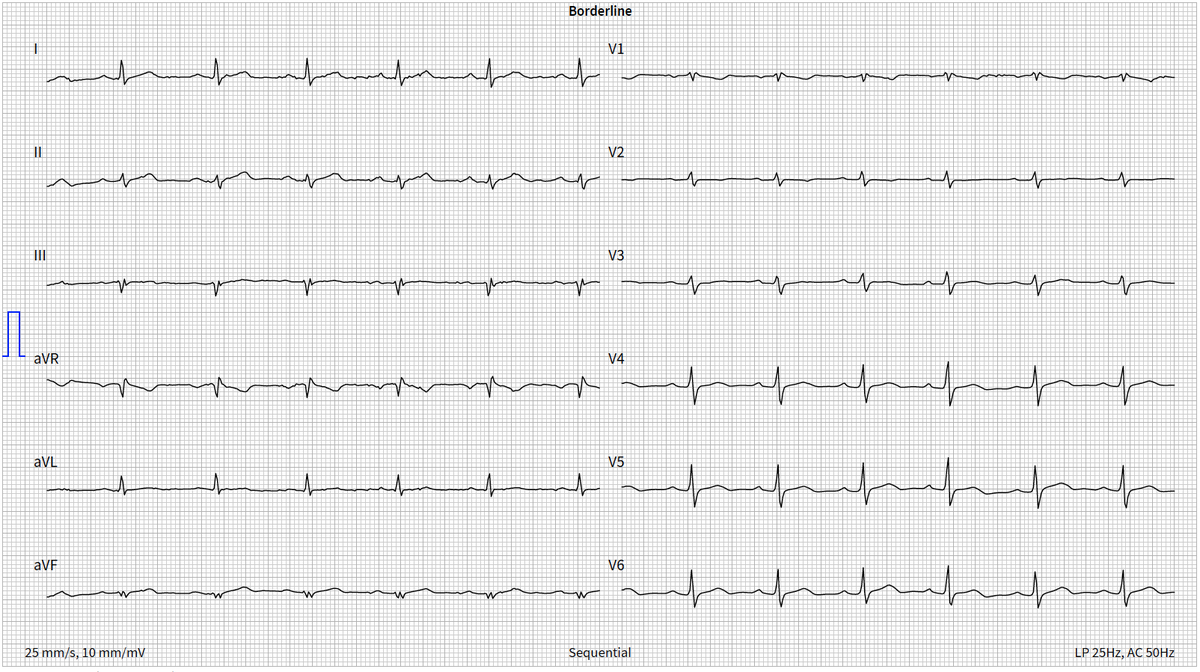 Emre Aslanger tweet media
