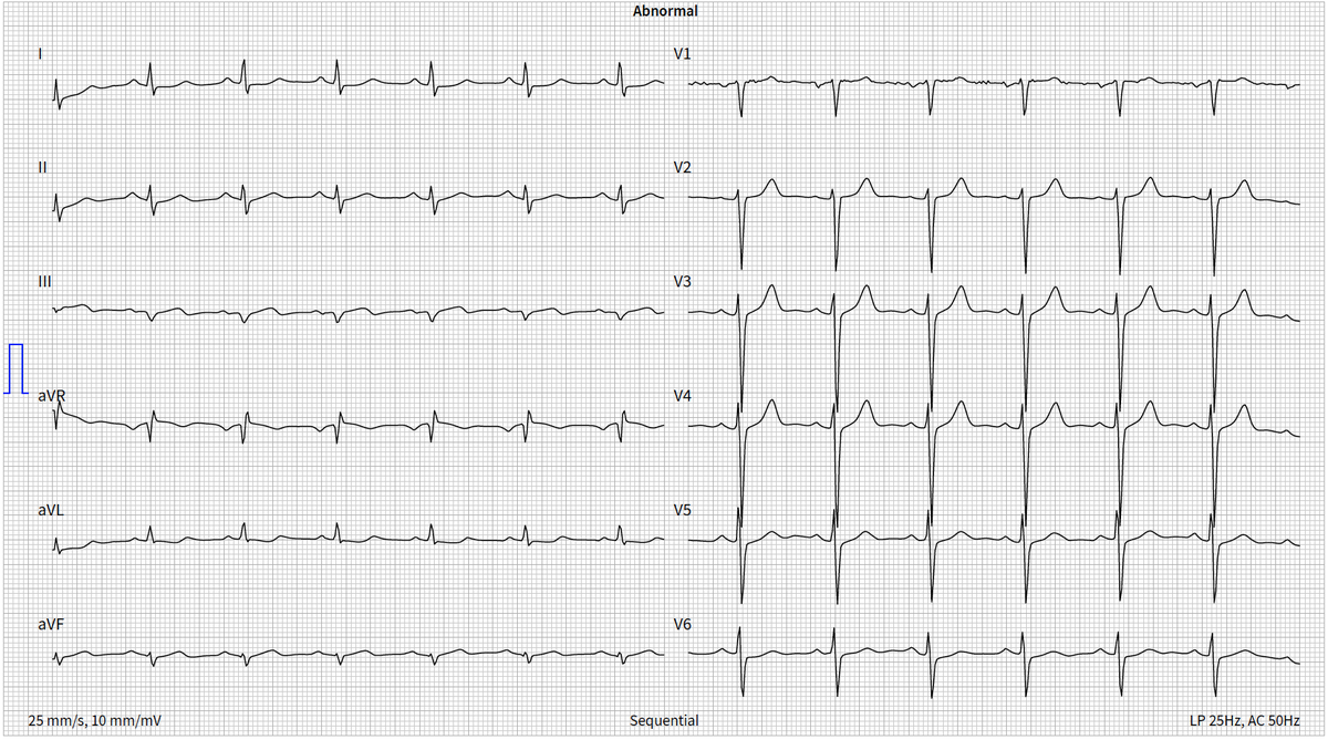 Emre Aslanger tweet media