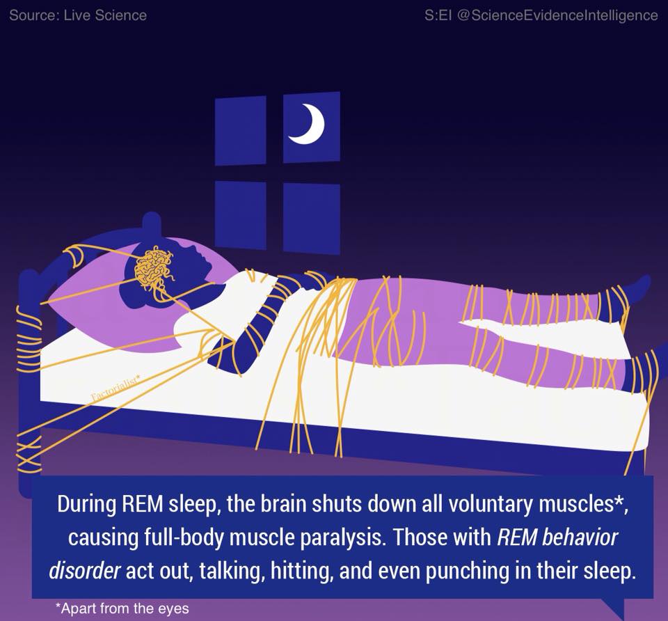 @i_Ahmedalhmdan أما بالنسبة للتسمية العلمية للجاثوم هي " شللّ النوم" أو "Sleep Paralysis"
وهي حالة تصيب بعض البشر، ينشط فيها وعي الدماغ والعصب البصري، ولكن يكون الجسد في حالة النوم وعضلاته مشلولة تمامًا ولا يستطيع الحركة ولا إصدار الصوت، فقط يرى
وكأنّ الوعي محبوس ما بين اليقظة والنّوم