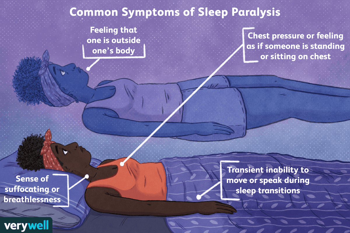 @i_Ahmedalhmdan أما بالنسبة للتسمية العلمية للجاثوم هي " شللّ النوم" أو "Sleep Paralysis"
وهي حالة تصيب بعض البشر، ينشط فيها وعي الدماغ والعصب البصري، ولكن يكون الجسد في حالة النوم وعضلاته مشلولة تمامًا ولا يستطيع الحركة ولا إصدار الصوت، فقط يرى
وكأنّ الوعي محبوس ما بين اليقظة والنّوم