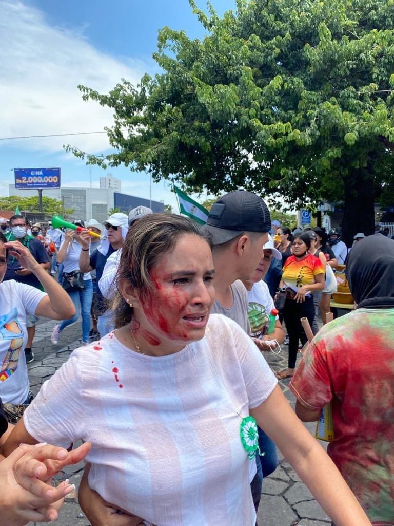 MReneAlvarezScz's tweet photo. Último Momento!!!
Nuestras asambleistas fueron brutalmente agredidas y gasificadas por la policía, en la marcha pacífica pidiendo la liberación de nuestro gobernador @LuisFerCamachoV https://t.co/XKNbY4hlae
