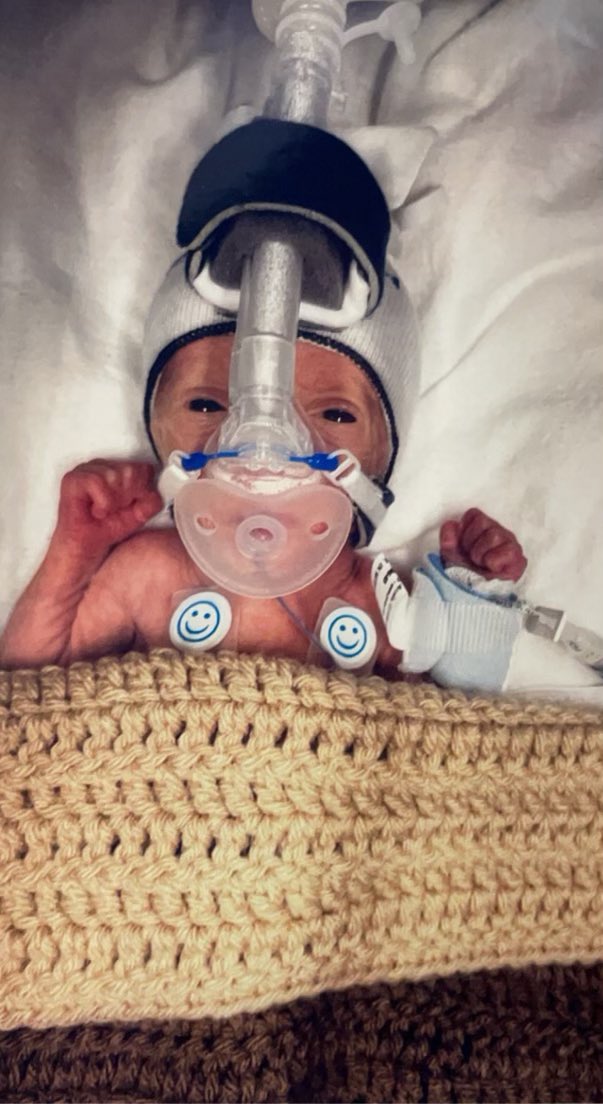 its_benoit's tweet image. The most perfect and strongest little boy I ever laid my eyes on ❤️