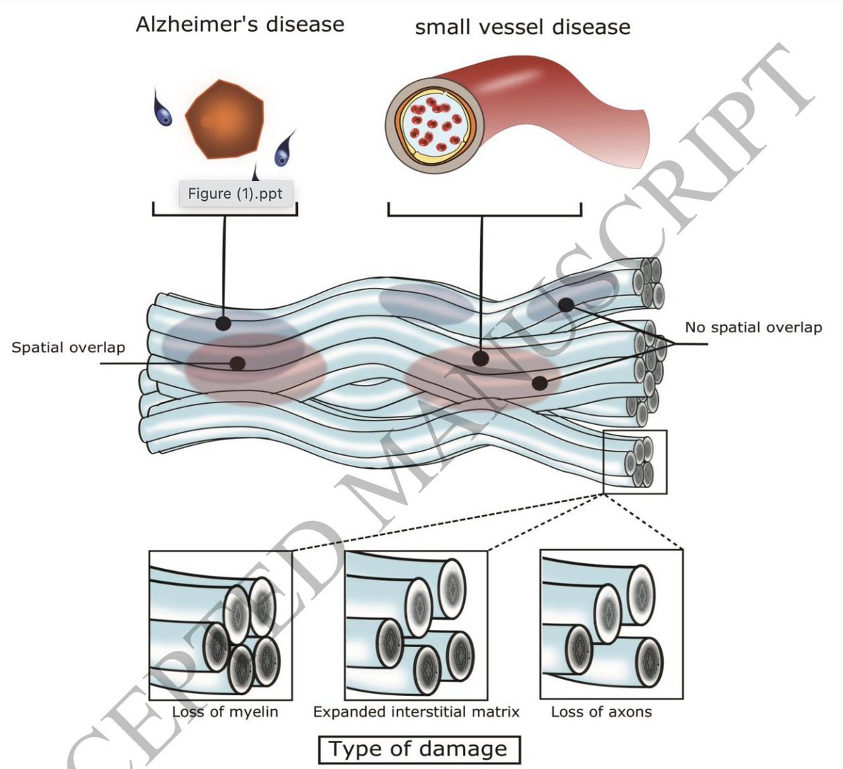 Alzheimers vs vascular disease; white matter spots on your MRI scans? I love this commentary as it hits the right notes on the challenges of understanding and disentangling. The more we know, the more we are digesting the complexity of the brain changes. academic.oup.com/brain/advance-…