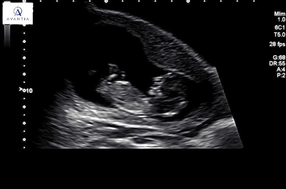 YCR Brownjohnn tweet media