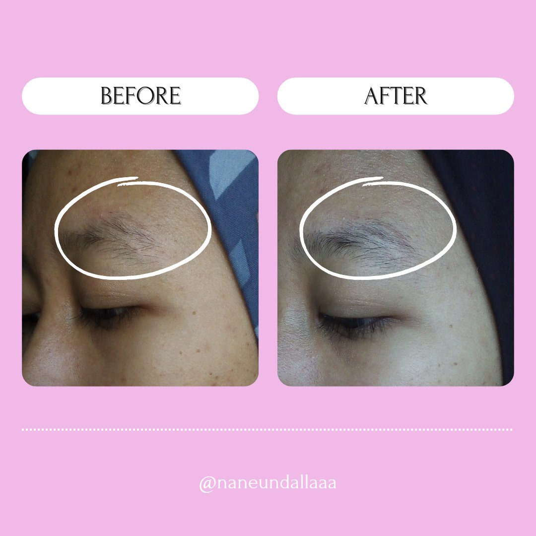 naneundallaaa's tweet photo. Pudding bukan sembarang pudding, pudding yang ini beda ya bukan untuk dimakan tapi dipakai di kulit. Seneng banget akhirnya aku bisa coba setelah sekian lama ngewishlist.
✨ADARA P.M.S CERAMIDE PUDDING MOISTURIZER✨
#racuninskincare #PMSnoWorries #ProtectMySkin https://t.co/KMC0c3ypuj