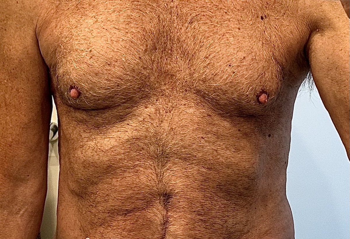 XLHungAdenDaddy's tweet photo. Daddy’s hairy chest #dadchest #hairychest #bator https://t.co/48OB09vwVD