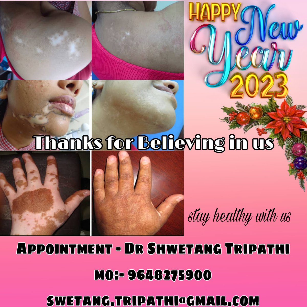 DrSwetang's tweet image. Thanks to all for your support and belief with us 
#HappyNewYear #leucoderma #homeopathy #tiwari_homeopathy