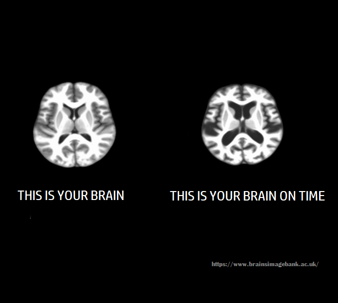 RT @Neuro_Skeptic: PSA: Time causes permanent changes to the brain. Avoid exposure to time for optimum brain health! https://t.co/GrxP7o1e3D