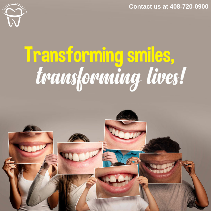sunnyvaledental's tweet image. Do you want to get your dream smile without wearing metal braces? 😁Try clear aligners for perfect teeth alignment with ease and to boost your self-esteem. 📲 Please click here to learn more: bit.ly/3RAPjTL 
#PPOinsurance #FamilyDentalCare #TeethAlignment #AlignedTeeth