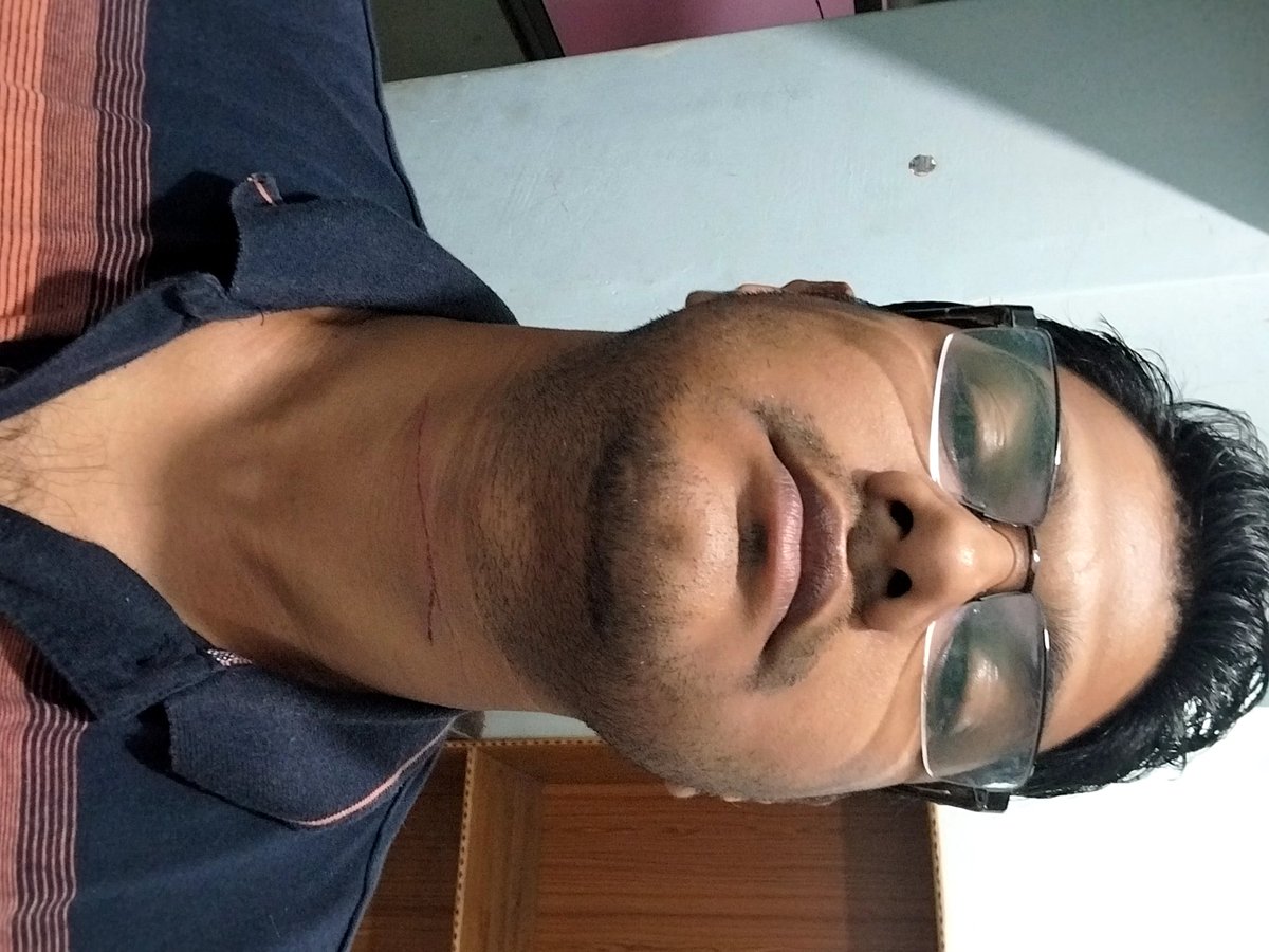 anilmahajan91's tweet photo. Cut on my neck after kite string(chinies manjha) stuck while riding bike,in Badadanda. @Puri_Official @SPPuri1 please take action. https://t.co/fRMxhgT6K5