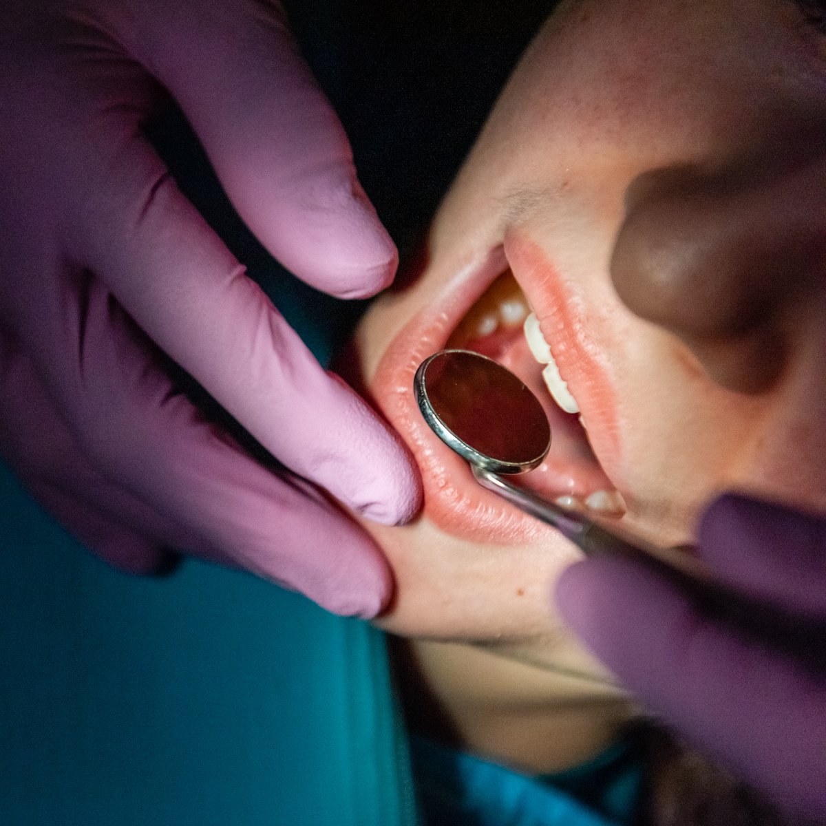 DonRobertsDDS's tweet photo. We're grateful for all the teeth we've cleaned and the smiles we've brightened this year. Here's to many more in 2023! https://t.co/WC2nK1AkqY