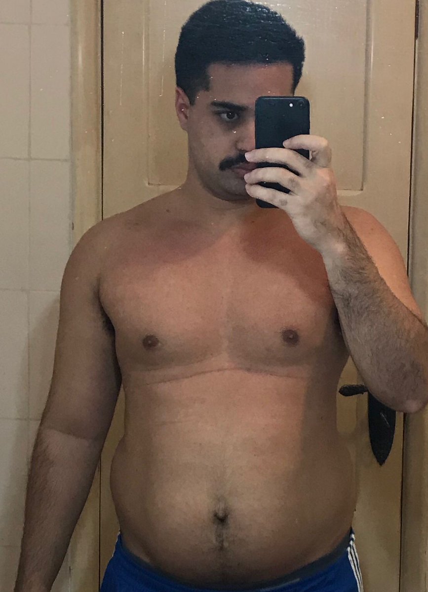 ramontnunes's tweet photo. 2022 foi um ano de saldo mt positivo. 
Durante a pandemia, bati 95kg. Nos ultimos 3 meses consegui manter uma rotina de treino, bati 82kg, com mais massa muscular e MUITO menos gordura.
Obesidade é uma doença e deve ser tratada, tive auxilio de um nutricionista no+ https://t.co/8Hu1OvRq6W