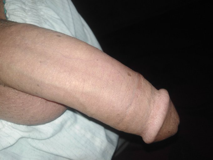 زبي تعبان وزعلان مين يدلعه