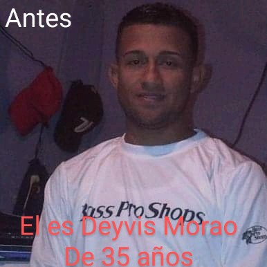 asovivir's tweet photo. @NicolasMaduro @MinpublicoVEN @TarekWiliamSaab @Minhvi_Oficial @ministeriosalud @MagaGutierrezV 
El es Deyvis Morao paciente renal actualmente en situación crítica por falta del PARICALCITOL medicamento que no suministra el IVSS desde el 2017 causando una Violacion de su derechos https://t.co/K0RmX8AGz3