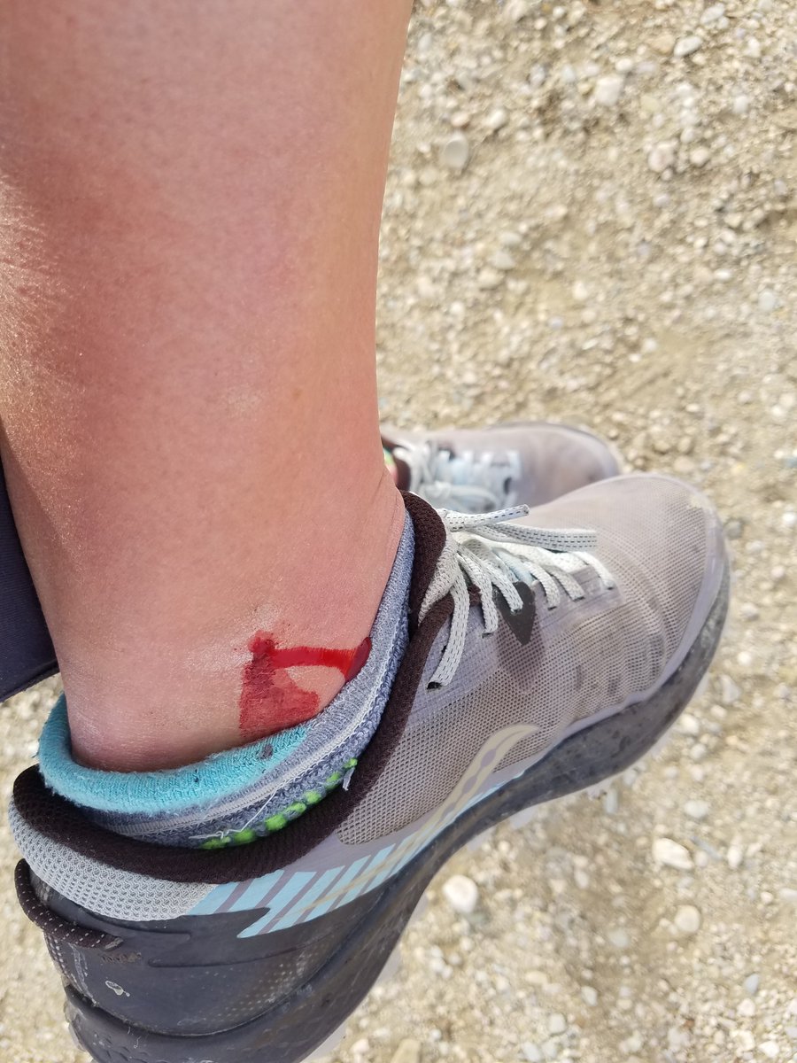 One would think I would notice I am kicking my other ankle while running before the blood starts pooling in my sock but what would be the fun in that.