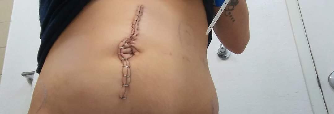NativeQueen999's tweet photo. Me and my family was in a wreck Christmas Eve. Me and my husband and son was air lifted. My son is in critical condition in Memphis Children's hospital. I had intestinal surgery my small intestine was ripped in half. My husband broke his hip&amp;knee. Cash app Shyswrld999 https://t.co/AyS6WAWKTB