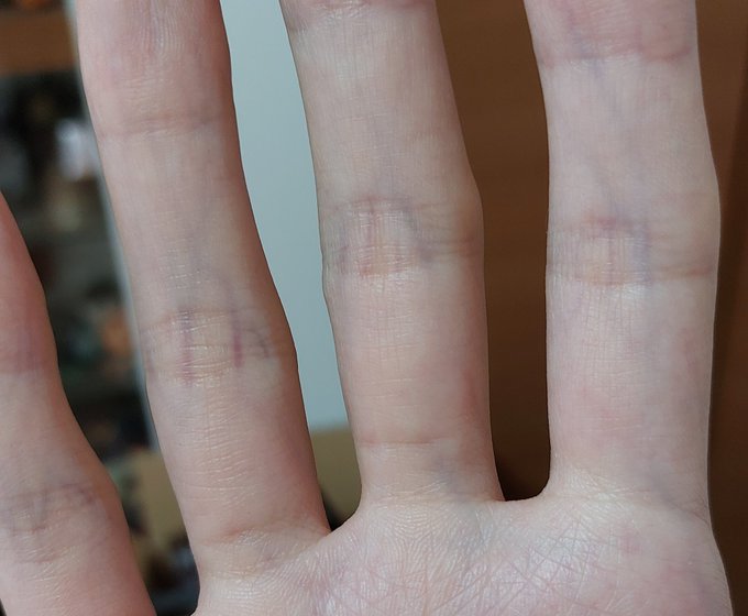 よくよく見たら指の血管の色青紫できれいだな 