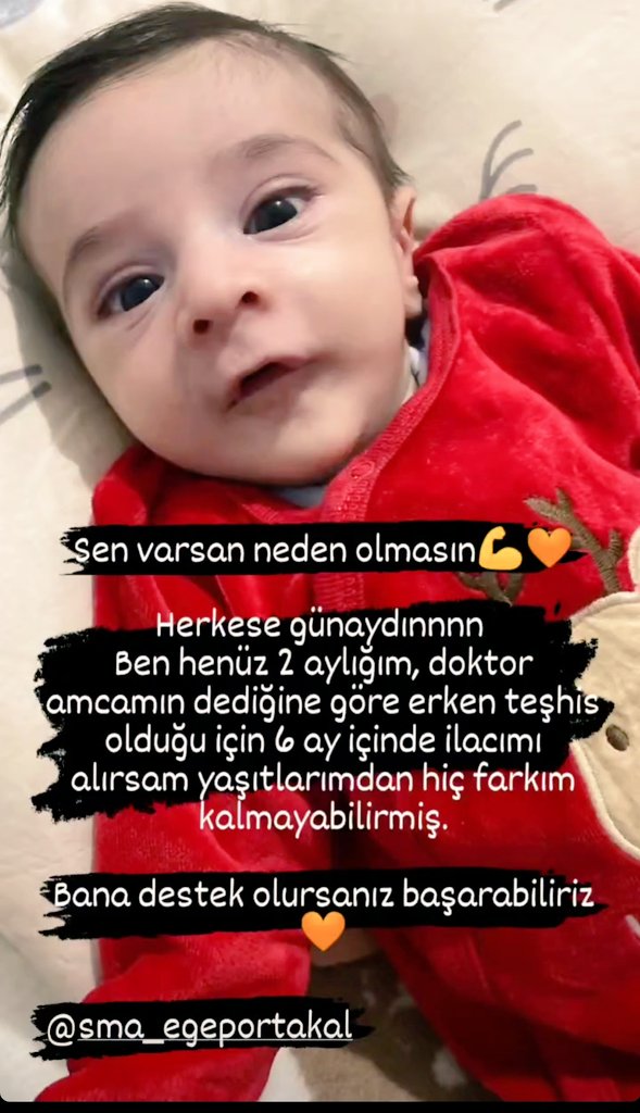 GngSevil's tweet photo. Bugün minik Çınar Ege için bir iyilik yapmak ister misiniz🧡

Onun mücadelesine maddi manevi desteklerinizi bekliyoruz. Lütfen sesini duyun ve duyurun🙏 

Çınar Ege'ye kocaman bir HAYAT armağan etmek elinizde 🧡 https://t.co/OiAO5eGfEu
