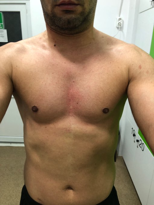 Happy new Year !!🥂  First monday in 2023, first chest day! ⬇️⬇️⬇️⬇️⬇️⬇️⬇️⬇️⬇️ https://t.co/fPJuxc2i52  #gym<a href="/tag/gym"class="tags"><span>#gym</span></a><a href="/tag/gymlife"class="tags"><span>#gymlife</span></a><a href="/tag/model"class="tags"><span>#model</span></a><a href="/tag/lgbt"class="tags"><span>#lgbt</span></a><a href="/tag/workout"class="tags"><span>#workout</span></a><a href="/tag/male"class="tags"><span>#male</span></a><a href="/tag/chestday"class="tags"><span>#chestday</span></a>