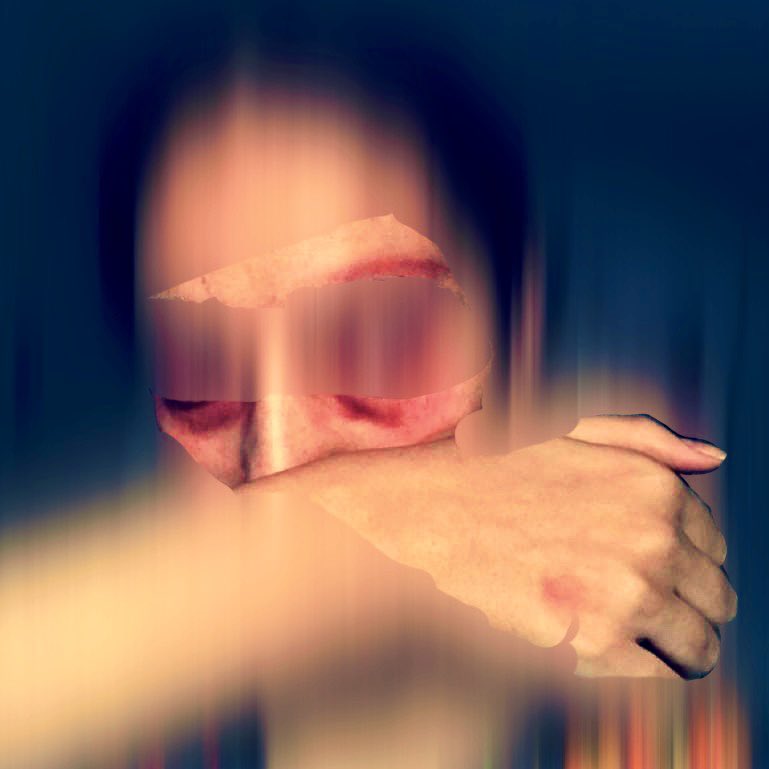 mortazabehboudi's tweet photo. ❌ Une amie journaliste afghane a été fouettée gravement par les talibans alors qu’elle réalisait un reportage à Kaboul. Elle a été emmenée au commissariat et a été menacée de mort si elle continue à travailler en tant que journaliste. @RSF_inter @RSF_fr ? https://t.co/bbDI9p24Rn