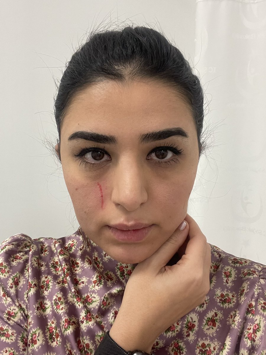 tugba karakaş (@krkstgb) on Twitter photo Yılın ilk dağlıkta şiddet olayını da yayınlayacak mısınız sayın bakanım <a href="/drfahrettinkoca/">Dr. Fahrettin Koca</a> poliklinikte hastalarıma bakarken darp edildim . Hastalarıma hizmet vermeye çalışırken Yılın ilk dağlıkta şiddet olayını da yayınlayacak mısınız sayın bakanım <a href="/drfahrettinkoca/">Dr. Fahrettin Koca</a> poliklinikte hastalarıma bakarken darp edildim . Hastalarıma hizmet vermeye çalışırken
