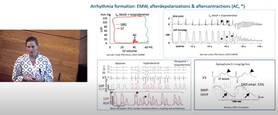 Henk van der Linde (@henkvanderlin12) on Twitter photo Start this year good and watch this interesting presentation of <a href="/RachelterBekke/">Rachel ter Bekke</a> at the AICC Conference 2022, #electromechanicalwindow: risk prediction tool in the long-QT syndrome youtube.com/watch?v=cyFKvc… Start this year good and watch this interesting presentation of <a href="/RachelterBekke/">Rachel ter Bekke</a> at the AICC Conference 2022, #electromechanicalwindow: risk prediction tool in the long-QT syndrome youtube.com/watch?v=cyFKvc…