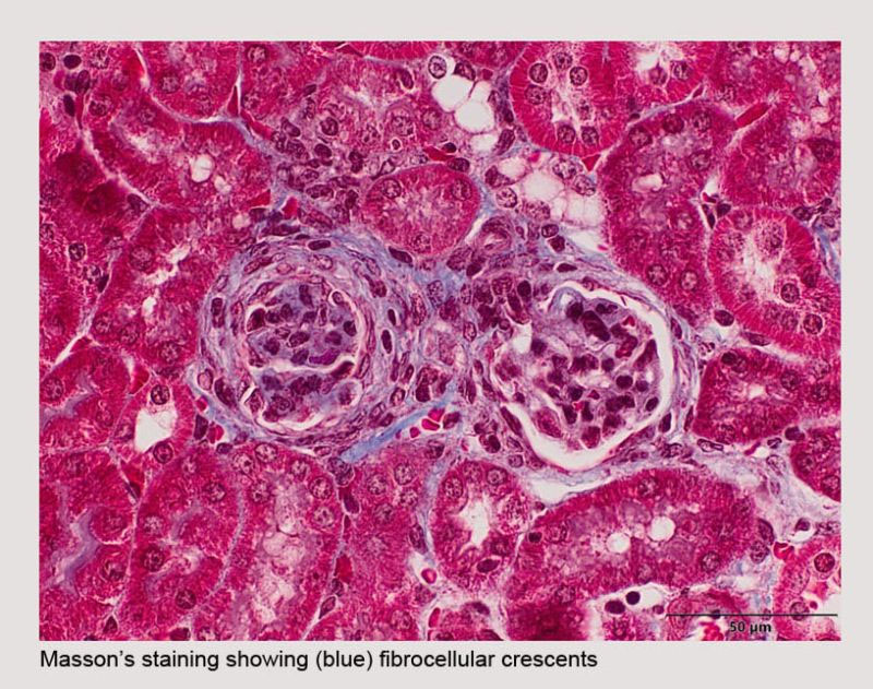 Excited to share this beautiful histopathology image showing #fibrosis in the #glomeruli of the #kidneys of our new #humanized #IL23 #animalmodel of #lupus #autoimmunity developed by our R&amp;D scientists.