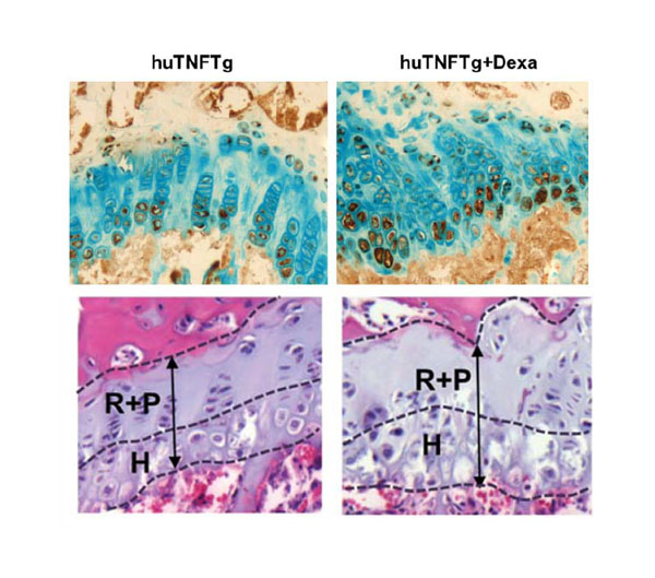 We are happy to have coauthored the study by Zhao Y et al at Scientific Reports (lnkd.in/dNk5iPke) where the human TNF transgenic #hTNFTg #Tg197 mice were used as #preclinical tool to show that #TNF and #Dexamethasone impair #bone growth in an additive manner.