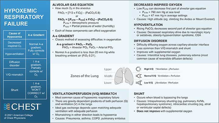 ApoThera's tweet photo. Hypoxemic Respiratory Failure
https://t.co/tmE6GiagYT
#ICU #clinic #MedTwitter #MedEd #FOAMcc #medstudents #Medstudent #CriticalCare #FOAMcc #healthcare #healthIT #pulmonologist #internalmedicine #DiGiTALhealth #TwitteRx #pulmonology #anesthesia #anesthesiology #Bioinformatics https://t.co/9CL8L6YXS3