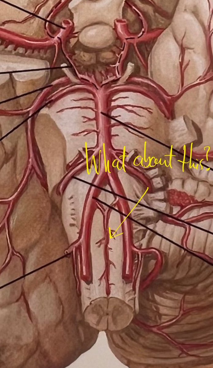 <a href="/OGdukeneurosurg/">Oren Gottfried, MD</a> This vessel is the reason we (vascular surgeons) do carotid-suvclavian bypasses when covering the left subclavian artery origin with a stent to treat an aortic aneurysm or dissection. As you can see it is supplied by both vertebrals.